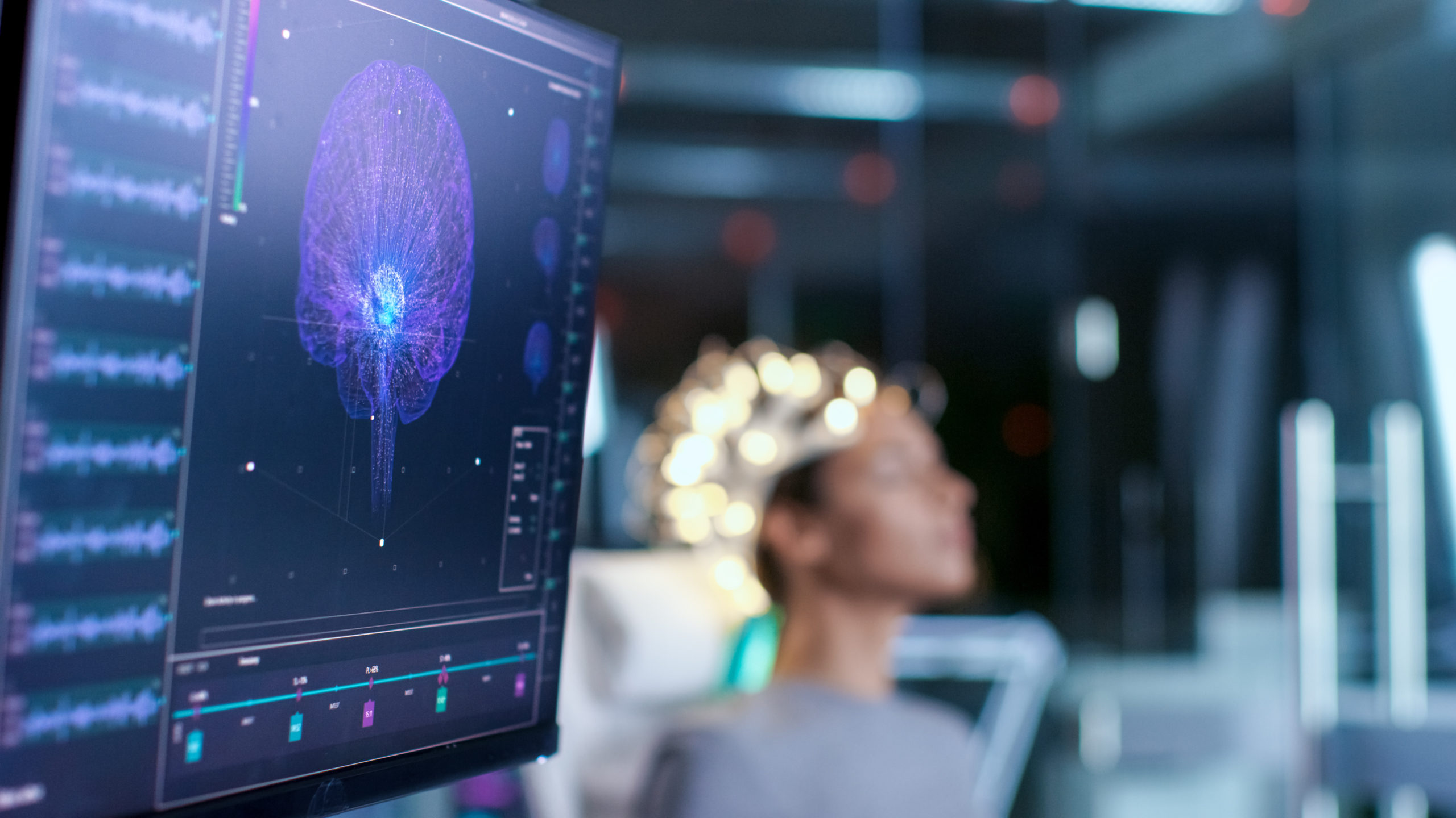 A monitor shows a brain scan on it, with an out-of-focus patient in the background